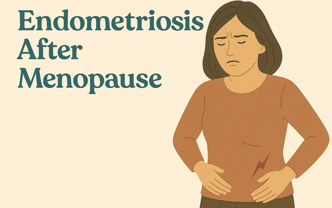 Can You Experience Endometriosis Symptoms After Menopause?