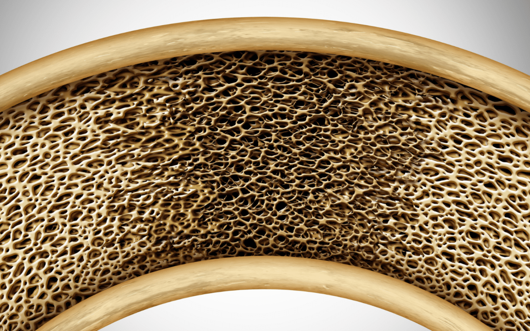 How Perimenopause and Menopause Trigger Bone Loss