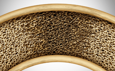 How Perimenopause and Menopause Trigger Bone Loss